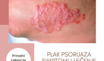 lecenje plak psorijaze prirodni putem