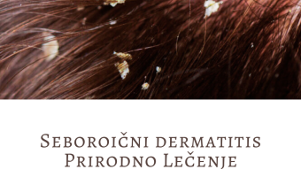 seboroicni dermatitis prirodno lecenje