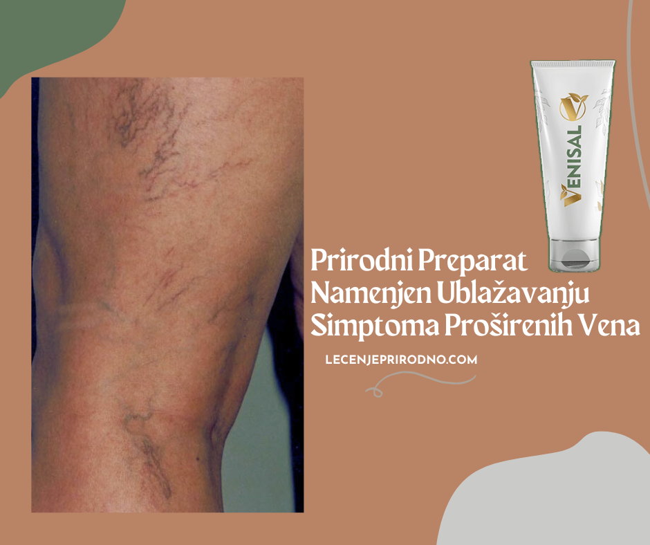 venisal gel za proširene vene
