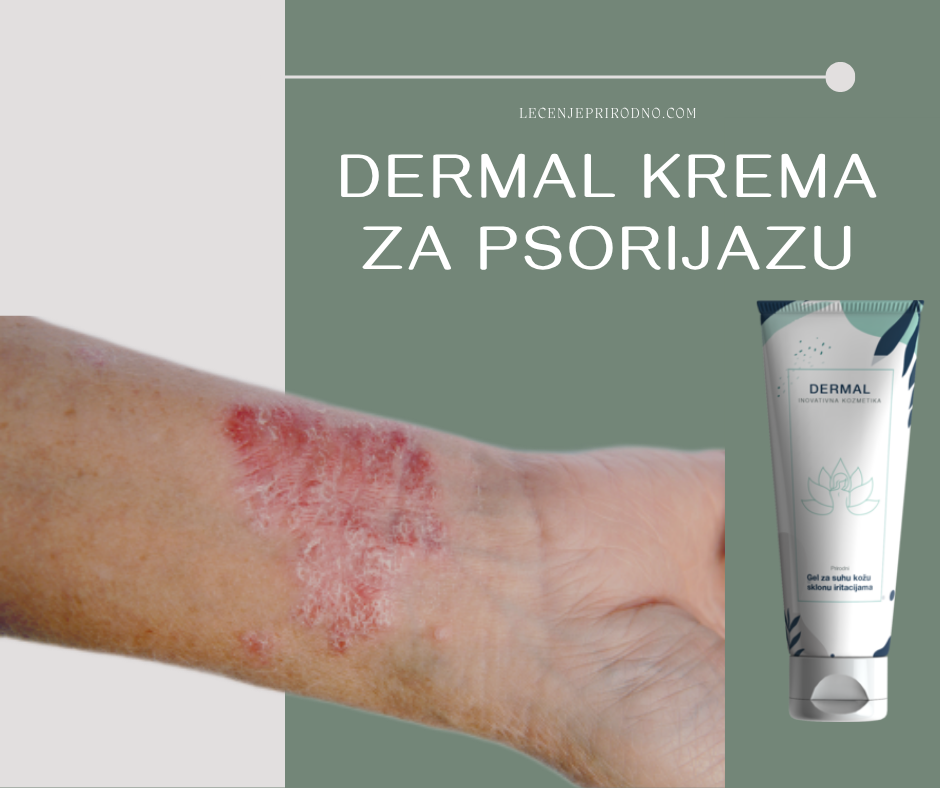 dermal krema za psorijazu